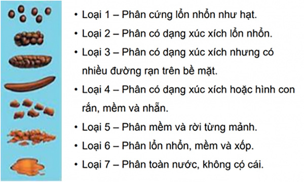 Tính chất phân - Một số điều cần biết về táo bón trẻ em