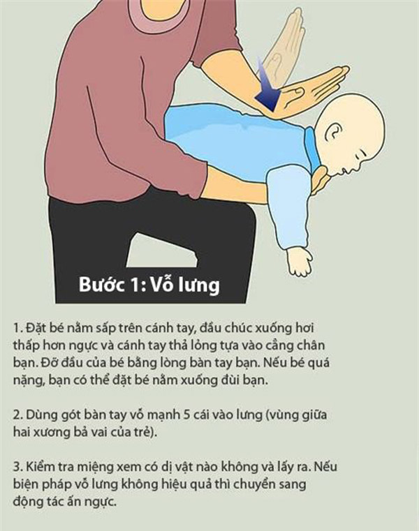 Từng bước xử lý đúng cách khi trẻ bị hóc - sặc